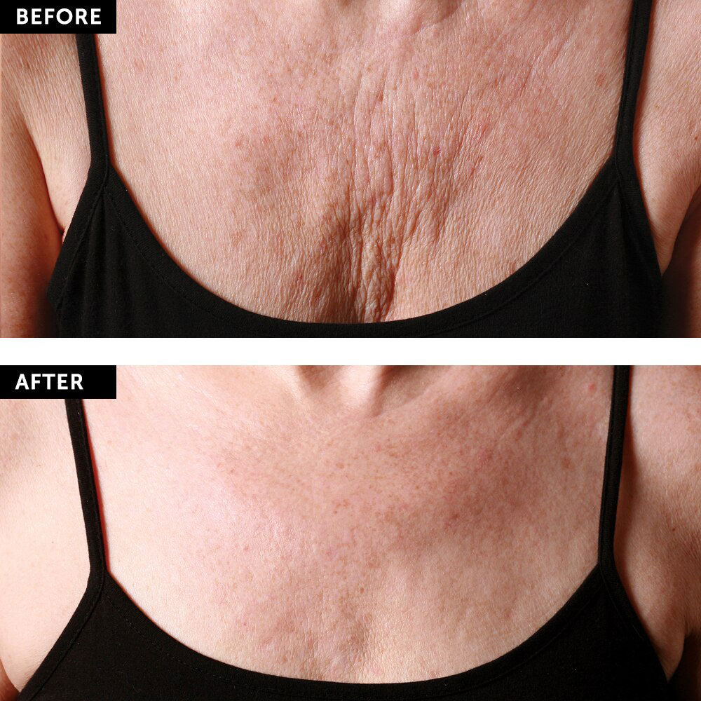 SILC SKIN Decollette Chest Wrinkle Pads